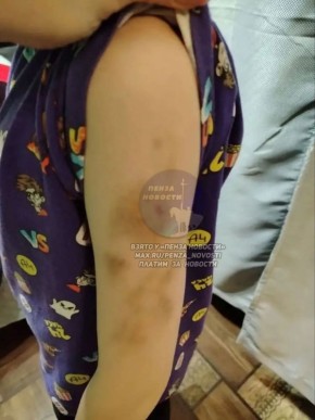 В Пензе прокуратура поставила на контроль проверку по факту избиения первоклассника в одной из школ в центре города