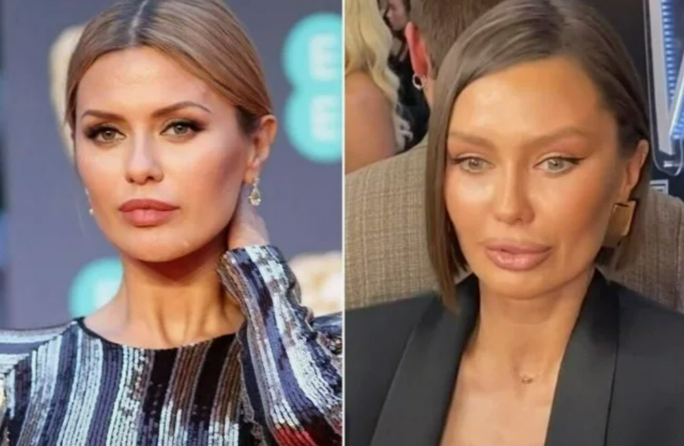 Очарование или искажение: знаменитости, изменившие себя до неузнаваемости